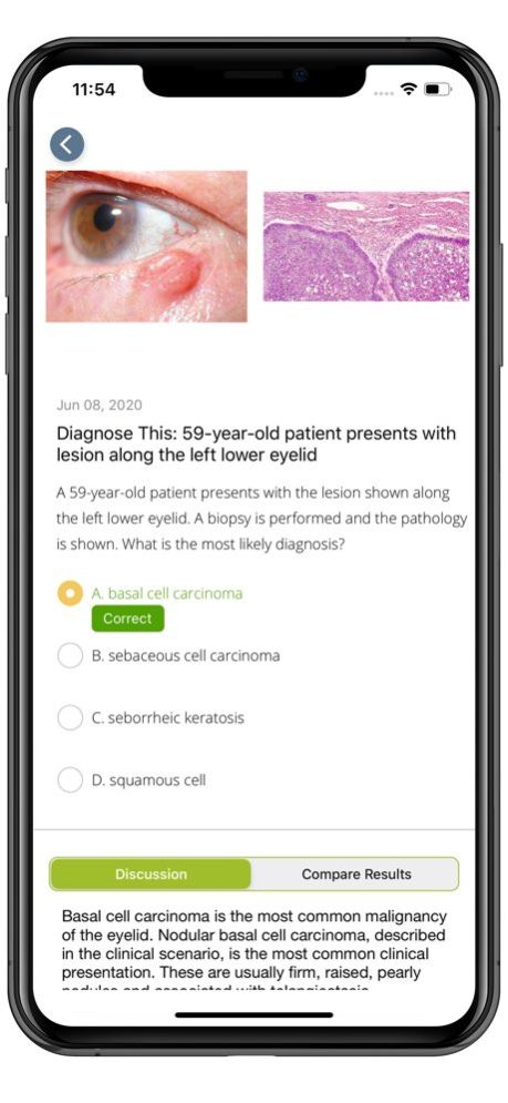 AAO Ophthalmic Education 3.0 Screenshot