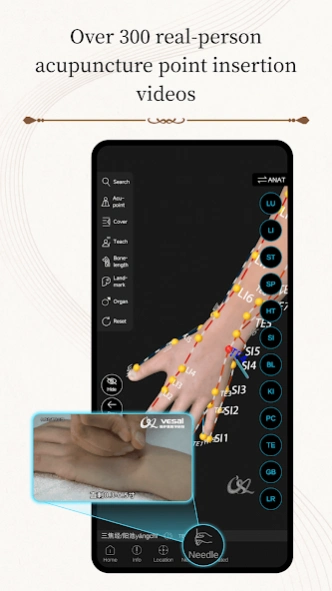 Acupuncture Master 3.1.4 Screenshot