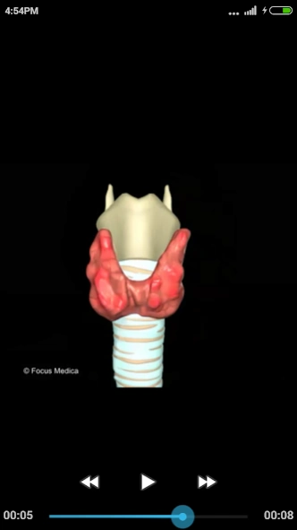 Animated Medical Dictionary  Screenshot
