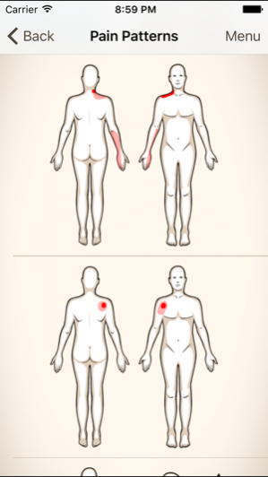 Clinical Pattern Recognition: Shoulder Pain 1.4.0 Screenshot