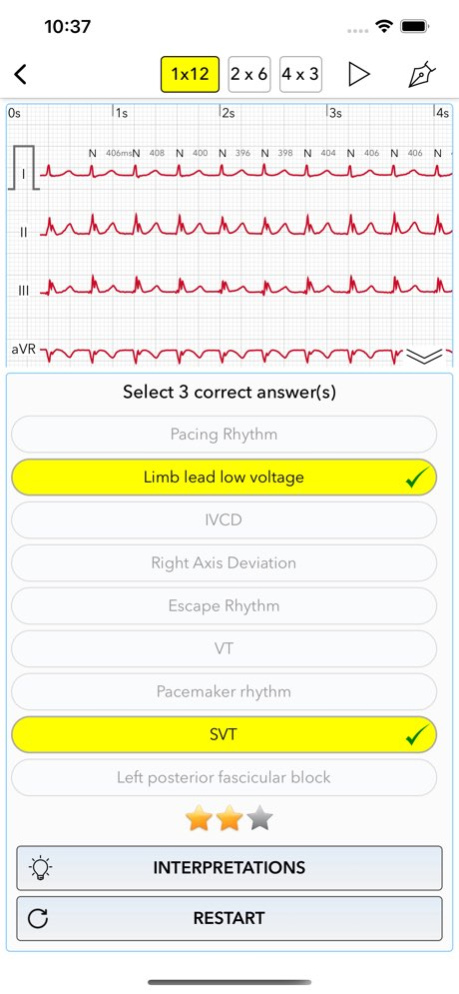 ECG Test for Doctors 2.1 Screenshot