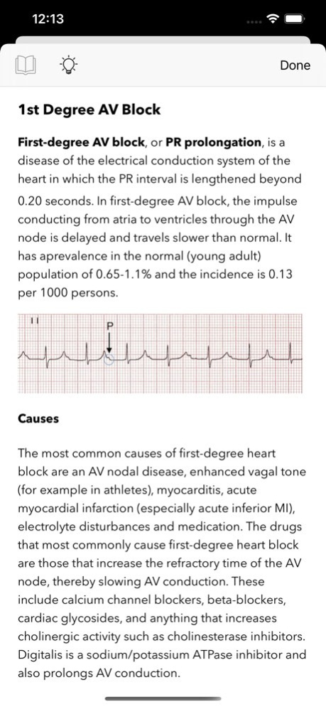 ECG Test for Doctors 2.1 Screenshot