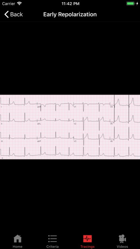 ECGsource 3.4 Screenshot