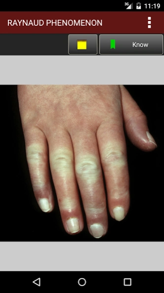 Fitzpatrick's Dermatology Flas 1.2 Screenshot