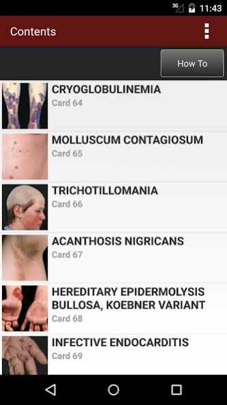 Fitzpatrick's Dermatology Flas 1.2 Screenshot