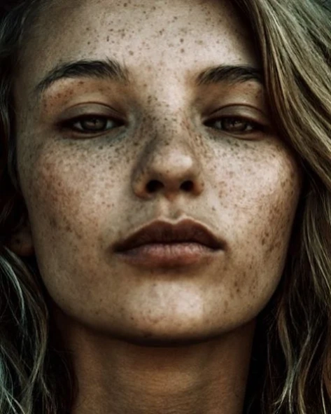 Freckles Tips  Screenshot