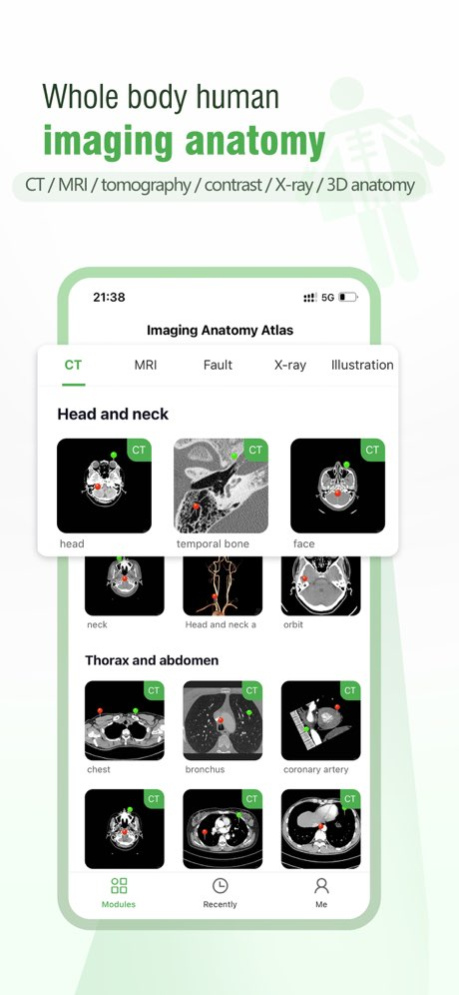 Imaging Anatomy Atlas 1.1.0 Screenshot