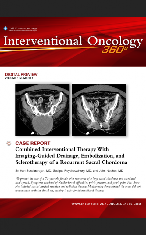 Interventional Oncology 360 1000000.7 Screenshot