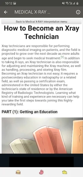 X RAY Interpretation - cases  Screenshot