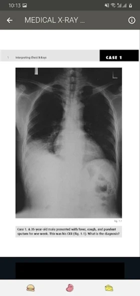 X RAY Interpretation - cases  Screenshot