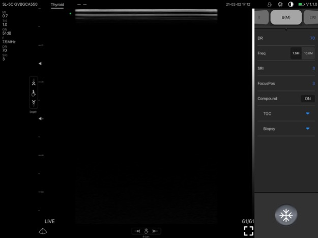 microVUE 1.3.39 Screen Photos 1
