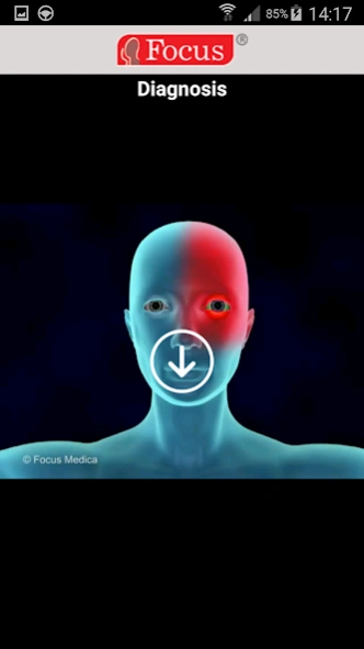 Migraine 1.0.2 Screenshot