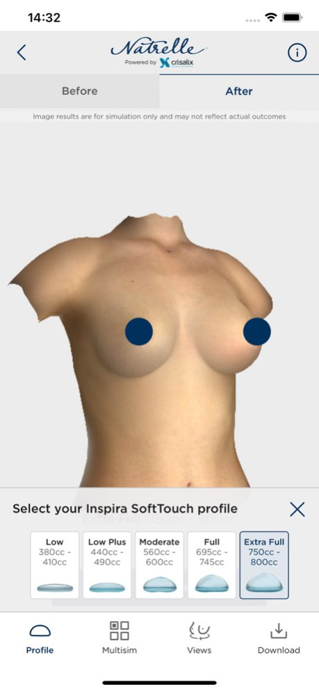Natrelle 3D Breast Visualizer 4.0.3 Screenshot