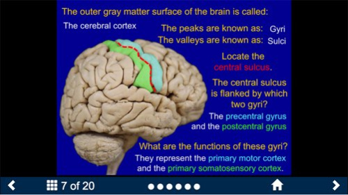 Neuroanatomy - SecondLook 3.1 Screenshot