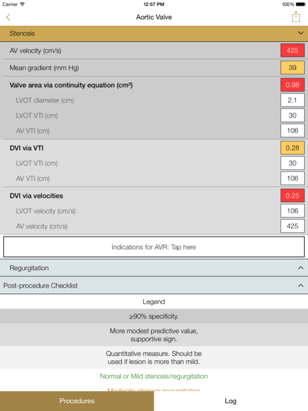 pEcho 1.2 Screenshot