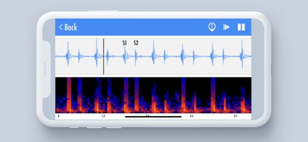 Stemoscope 2.1.3 Screenshot