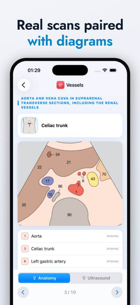 Ultrasound Anatomy Atlas 1.1 Screenshot