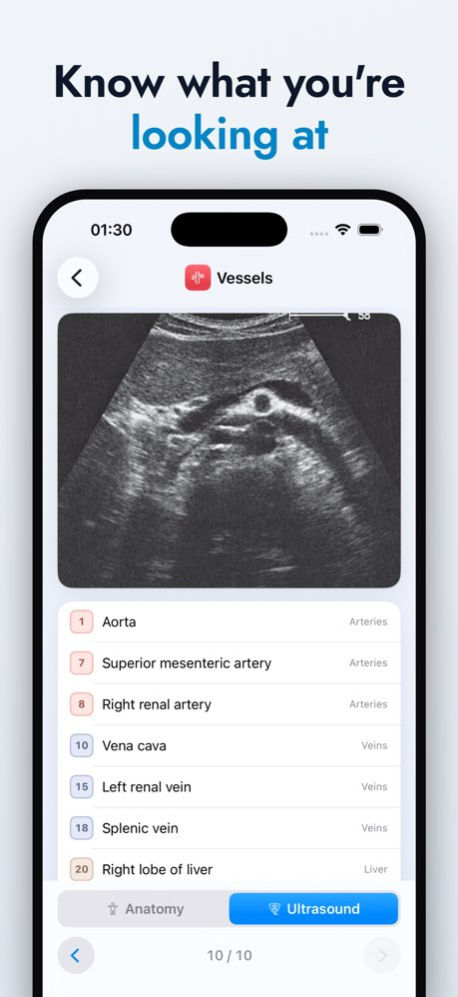 Ultrasound Anatomy Atlas 1.1 Screenshot
