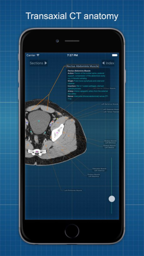 X-Anatomy Basic 3.2.0 Screenshot